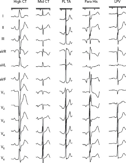 Figure 2: