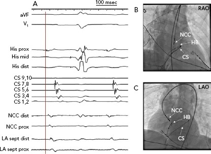 Figure 3: