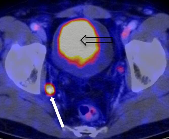 graphic file with name 120_2020_1389_Fig8_HTML.jpg