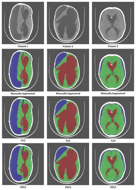 Fig. 10