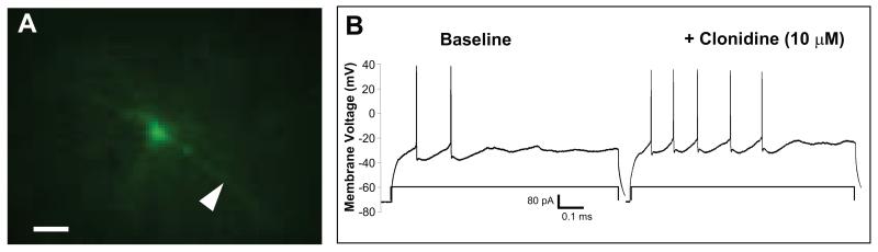 Figure 4