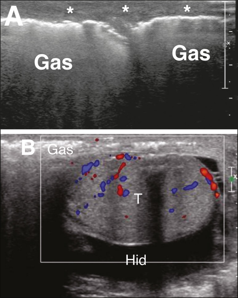 Figure 11