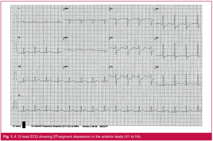 Fig. 1