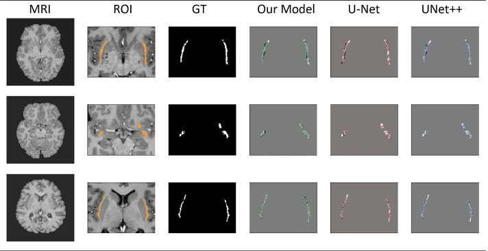 Fig. 12