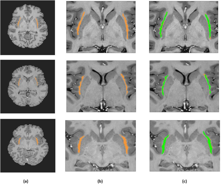 Fig. 9