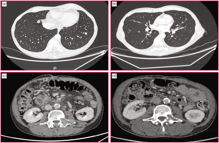 FIGURE 2