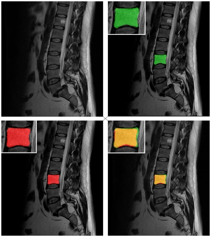 Figure 13