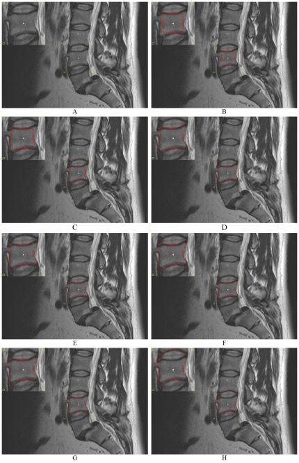 Figure 14