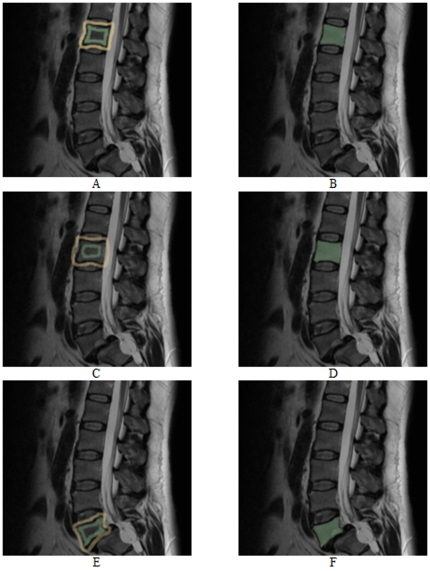 Figure 15