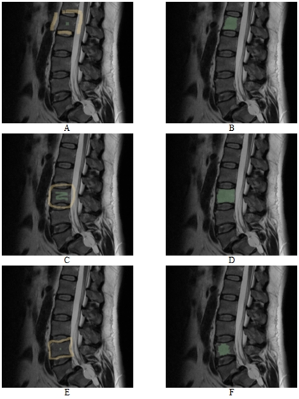 Figure 16