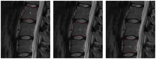 Figure 12