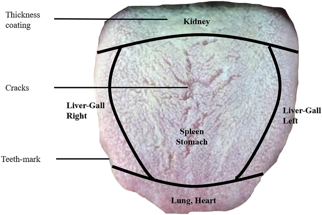 Figure 1: