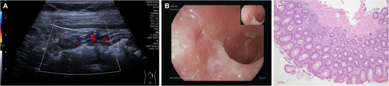 Figure 1