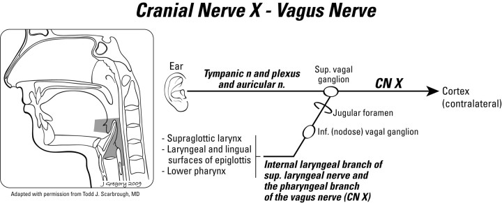 Fig 13.