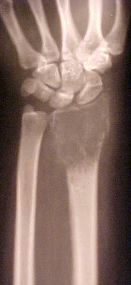 Fig. 2