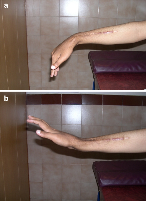 Fig. 4