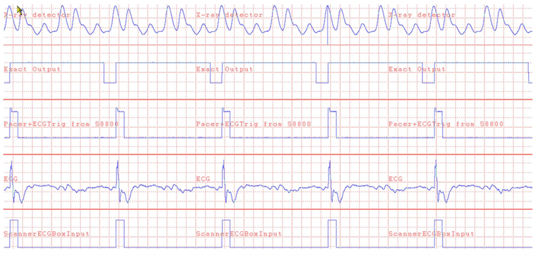 FIG. 3