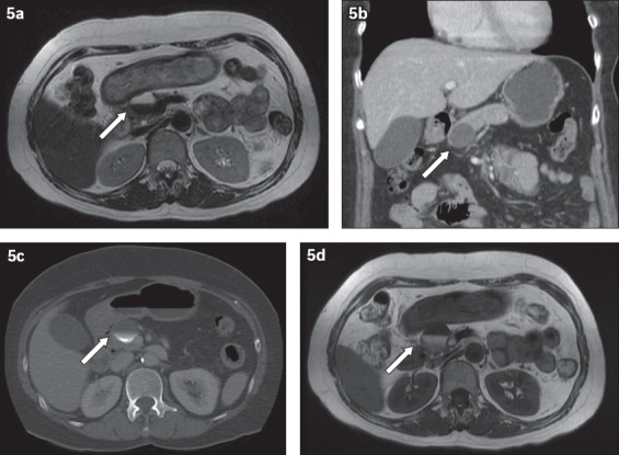 Fig. 5