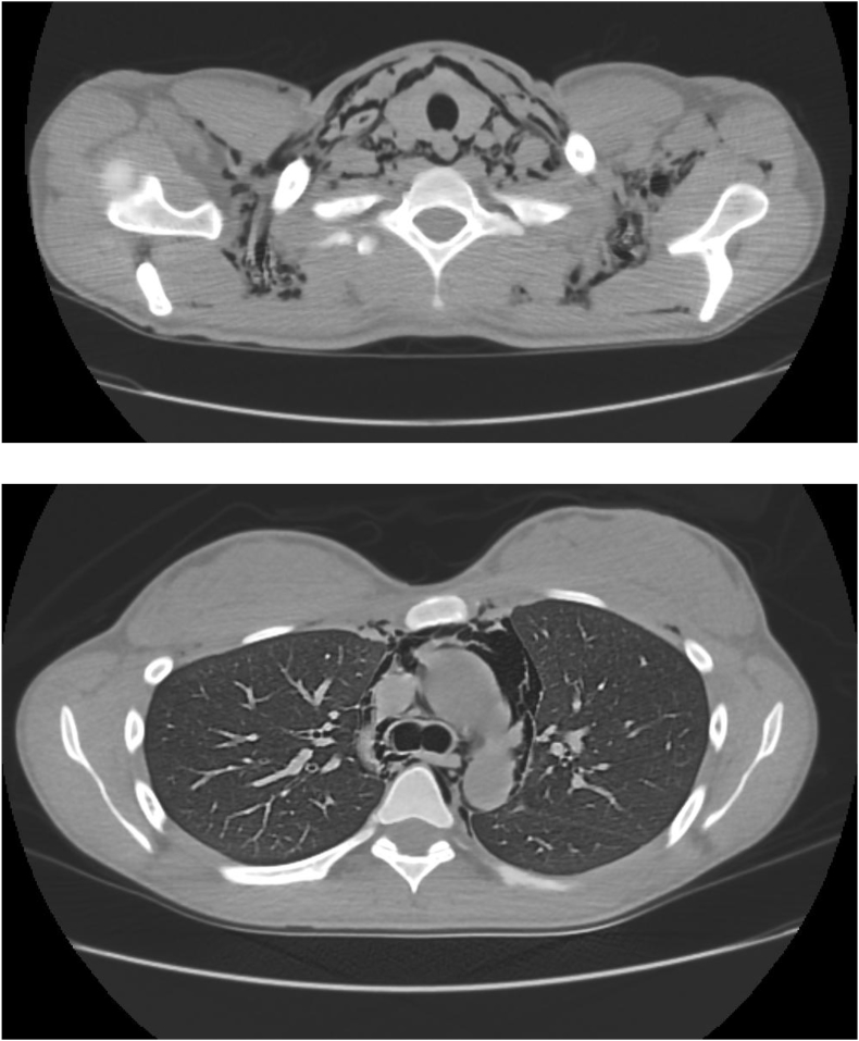 Fig. 2