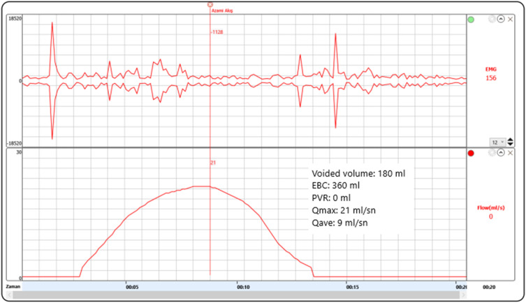 Fig. 2