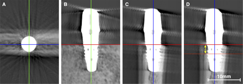 FIGURE 3