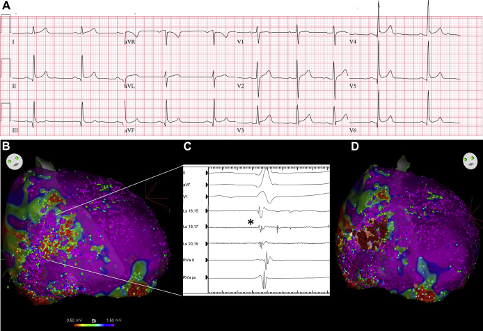 Figure 1