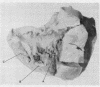 150