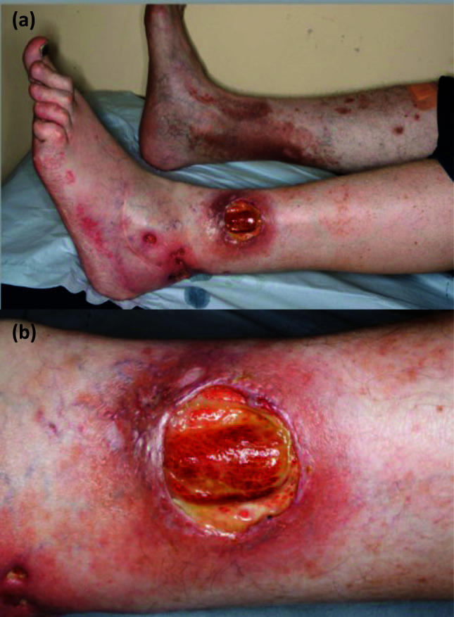 Fig 1.