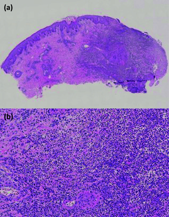 Fig 2.