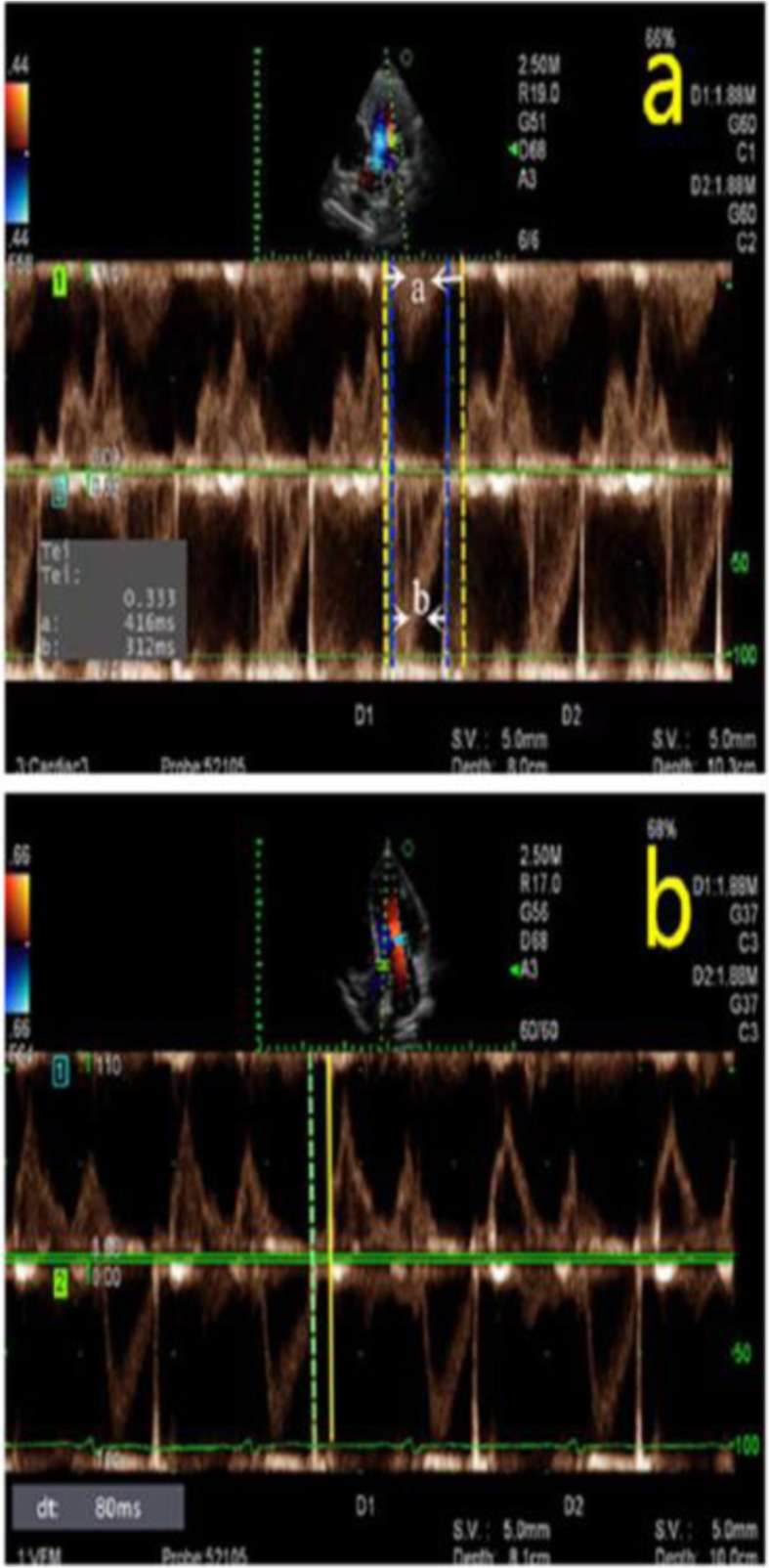 Fig. 4