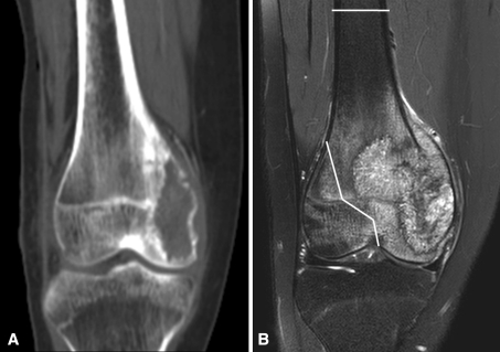 Fig. 1A–B