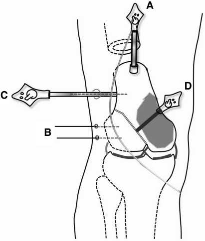 Fig. 5