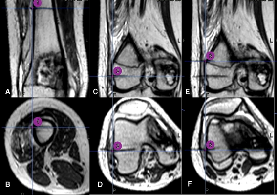 Fig. 2A–F