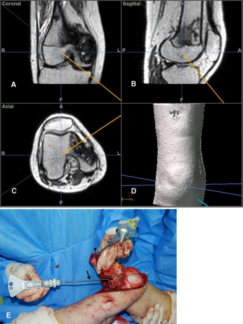 Fig. 4A–E