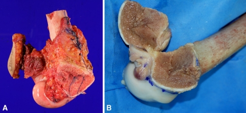 Fig. 6A–B