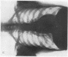 180