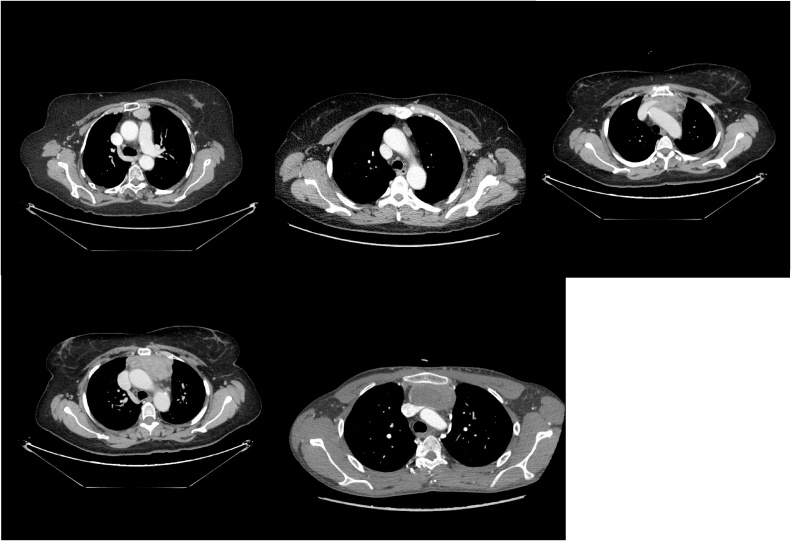 Figs. 2–6