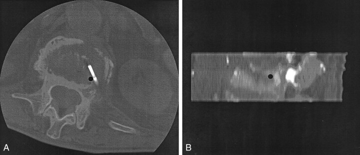 Fig 2.