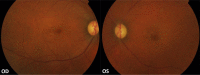 Fig. (1)