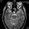 Fig. (2)