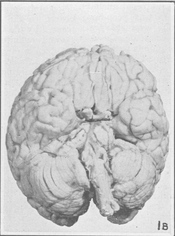 Fig. 1B