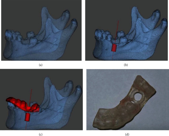 Figure 10