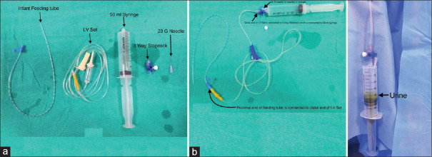 A Novel Equipment For Measuring The Urine Output In Paediatric Patients 