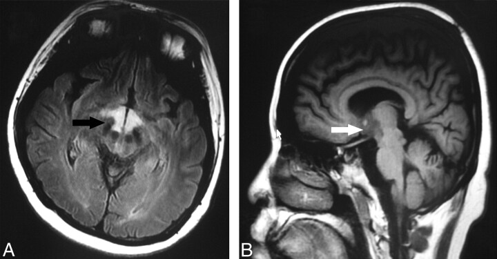 Fig 2.