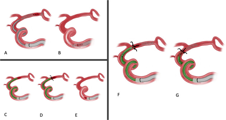 Figure 1.