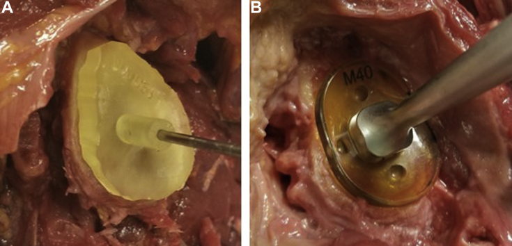 Figure 4