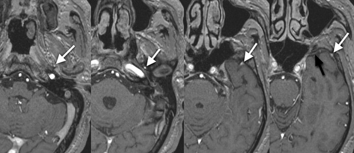 Fig 3.