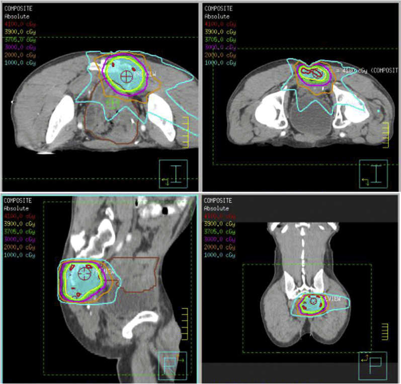 Figure 1