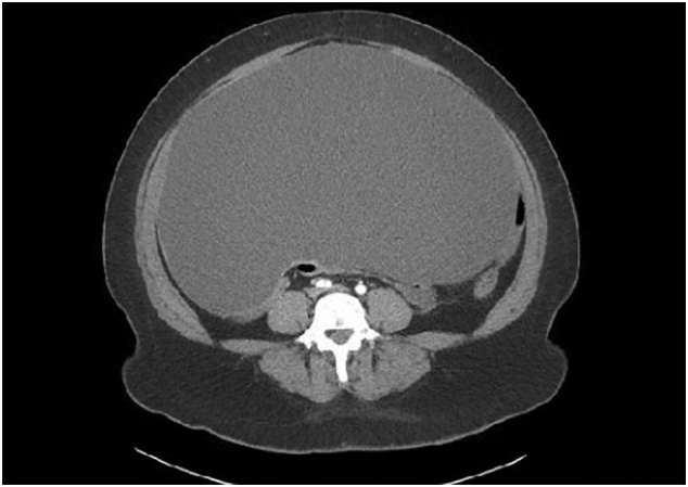 Fig. 1