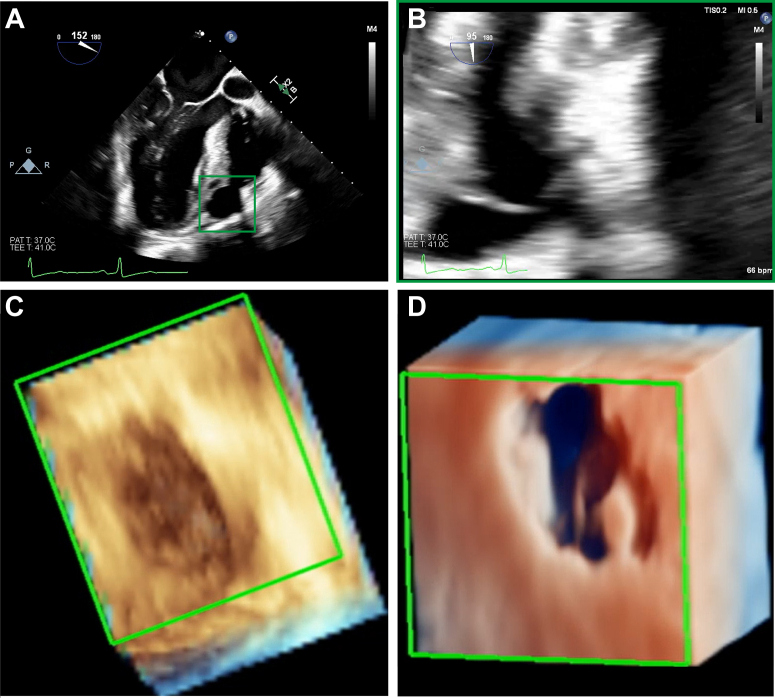 Figure 4